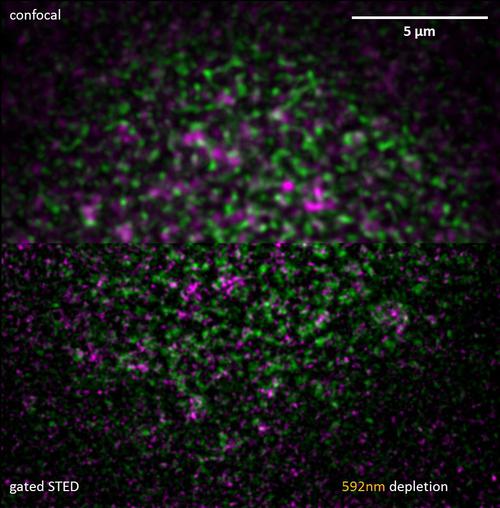徠卡顯微鏡適合RNA探針