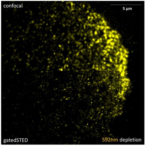 徠卡顯微鏡適合RNA探針