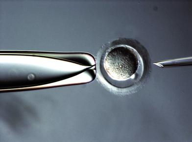 徠卡顯微鏡什么是綜合調節對比（IMC）？