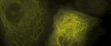 徠卡顯微鏡TIRF在生命科學研究中的應用