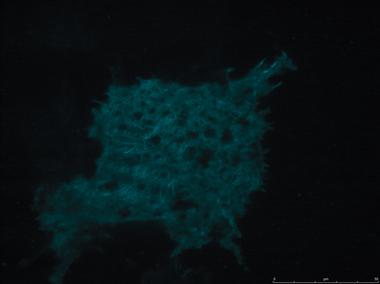 徠卡顯微鏡TIRF在生命科學研究中的應用