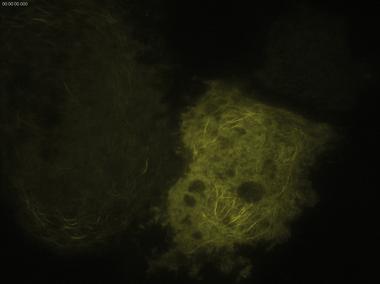 徠卡顯微鏡TIRF在生命科學研究中的應用