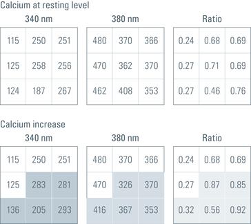徠卡顯微鏡通過測量熒光基團分析的離子濃度變化