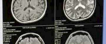 GE醫療研制出的節電省空間型磁共振成像裝置