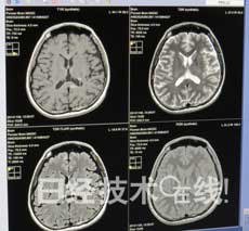 GE醫療研制出節電省空間型磁共振成像裝置