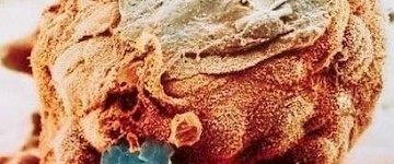 電子顯微鏡下生命的誕生