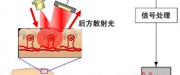 醫用激光血流計顯微鏡的涉及