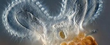 奧林巴斯顯微鏡數字圖片的美麗