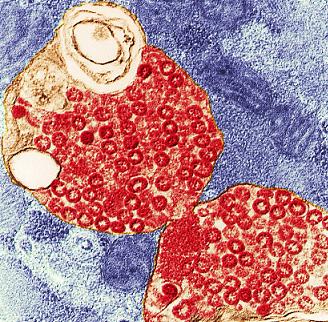 生物顯微鏡洞悉致命細菌