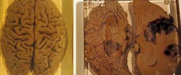 顯微鏡下的愛因斯坦大腦圖像